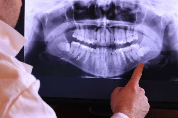 Best Emergency Dental Care for Broken or Chipped Teeth in Grand Saline, TX