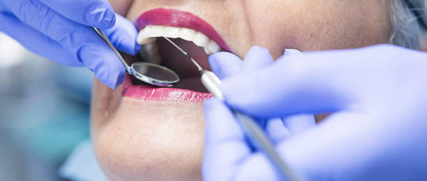 Best Emergency Dental Care for Broken or Chipped Teeth in Grand Saline, TX